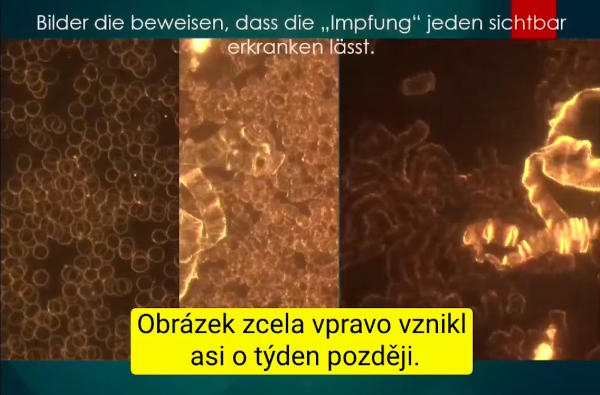 krev neockovaneho a ockovaneho